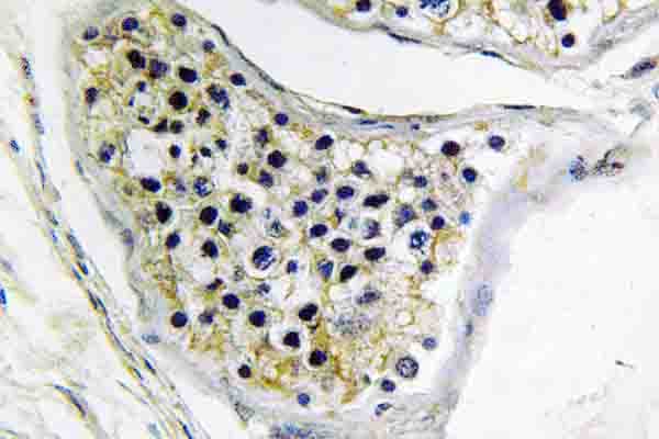 CNOT4 / CLONE243 Antibody (Glu95)