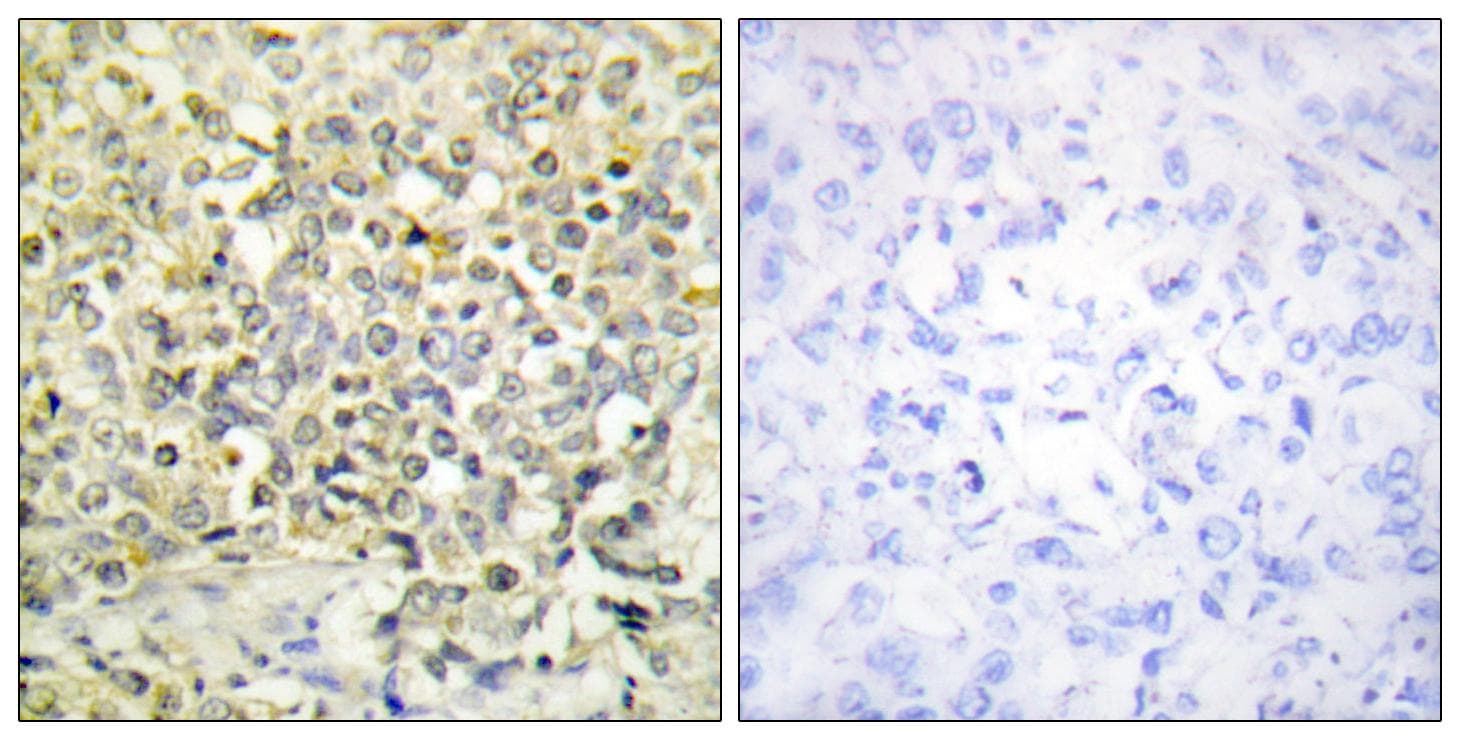 Polyclonal Rabbit anti-Human CDKL4 Antibody (IHC, IF, WB)