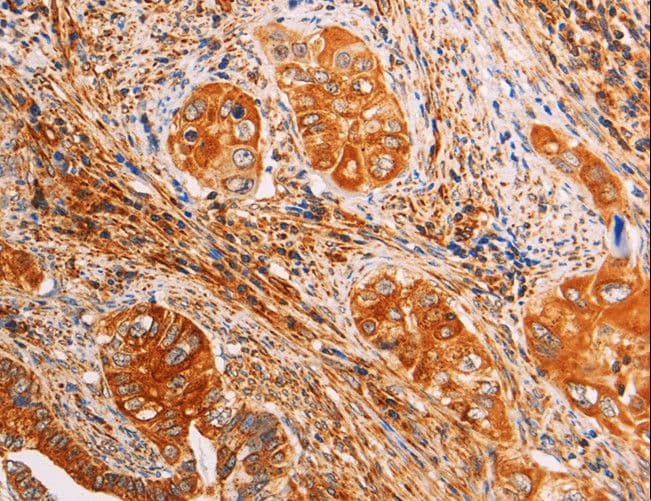 SLC25A4 / ANT Antibody