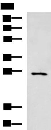 Polyclonal Rabbit anti-Human FSP27 / CIDEC Antibody (WB)