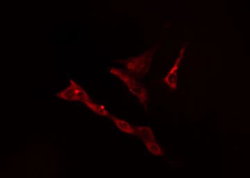 Polyclonal Rabbit anti-Human KLHL3 Antibody (IHC, IF, WB)