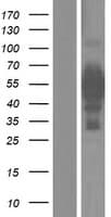 IRX5 Protein (Over-Expression Lysate Myc-DDK (Flag))