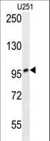 Polyclonal Rabbit anti-Human ZNF197 Antibody (aa314-343, IHC, WB)