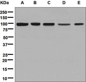 IHC-plus™ Monoclonal Rabbit anti-Human CLPTM1 Antibody (clone EPR8800, N-Terminus, IHC, IF, WB)