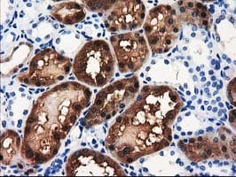 ACY3 Antibody (clone OTI4C1)