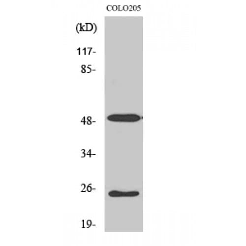 LRAT Antibody (80-160 aa, Internal)