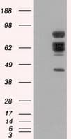 Monoclonal Mouse anti-Human XRCC1 Antibody (clone OTI2G8, WB)