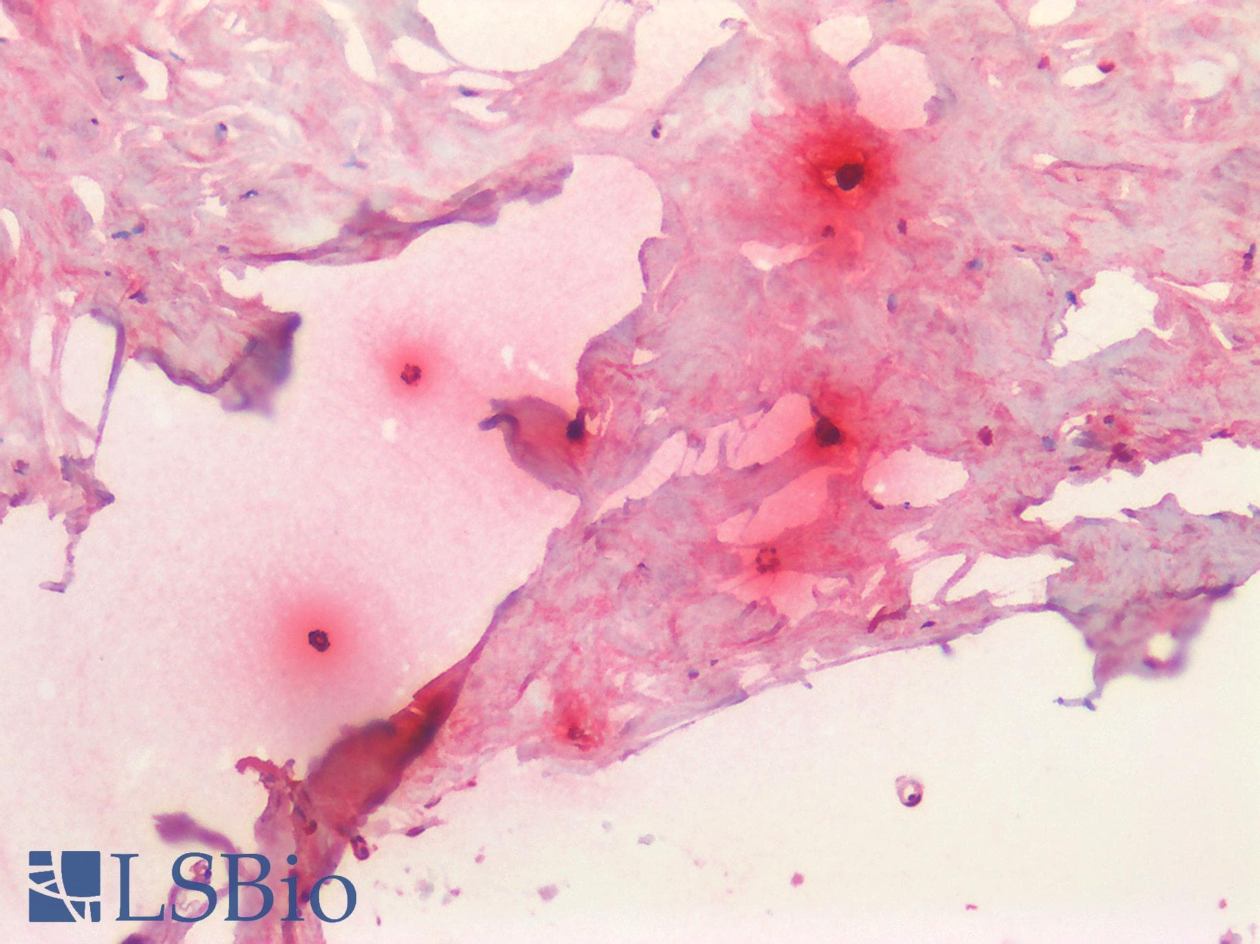 Monoclonal Mouse anti-Human TPSAB1 / Mast Cell Tryptase Antibody (clone C10, IHC, WB)
