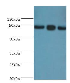 EZH2 Antibody (aa1-250)