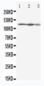 EIF3B Antibody (aa755-775)