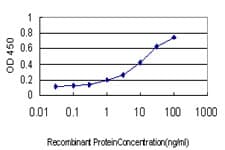 NR3C1/Glucocorticoid Receptor Antibody (clone 2C8)