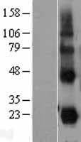 CD27L / CD70 Protein (Over-Expression Lysate Myc-DDK (Flag))