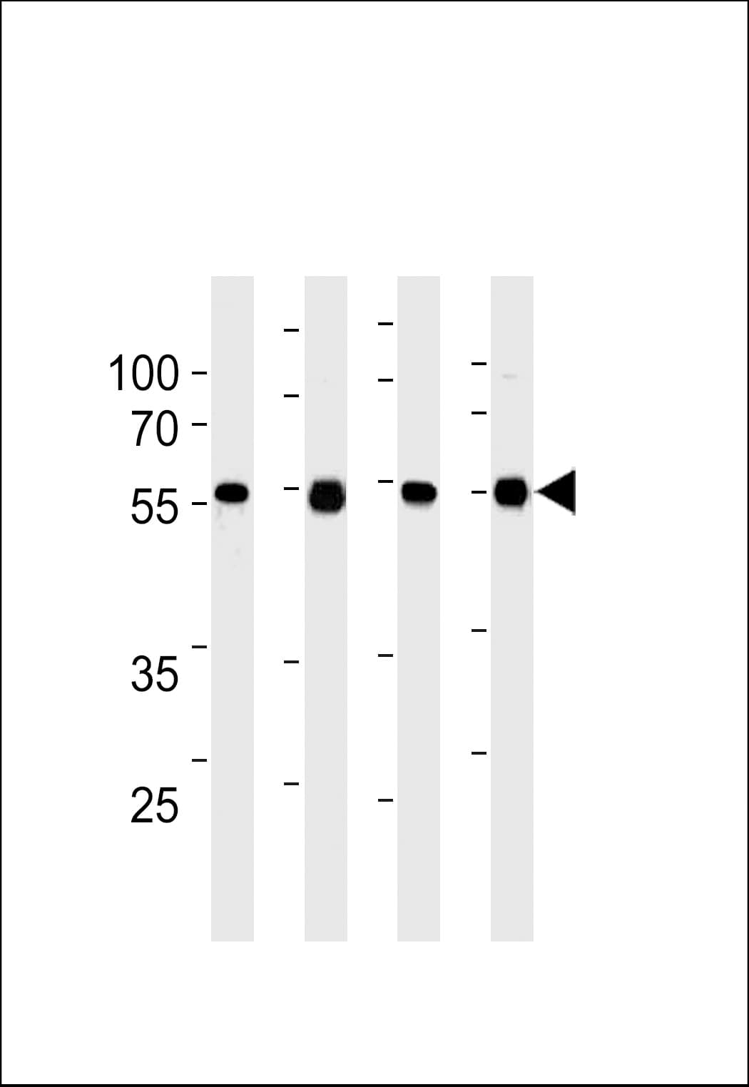 TPTE2 Antibody (clone 978CT6.1.4)