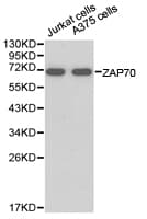 Polyclonal Rabbit anti-Human ZAP70 Antibody (IHC, WB)