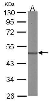 IHC-plus™ Polyclonal Rabbit anti-Human SDCCAG3 Antibody (aa218-435, IHC, WB)