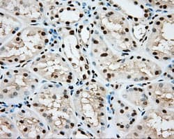 ARNT / HIF-1-Beta Antibody (clone OTI1A1)