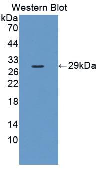 IL2RA / CD25 Antibody (aa22-245, Cy3)