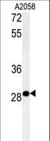 Polyclonal Rabbit anti-Human C11orf46 Antibody (aa228-257, WB)