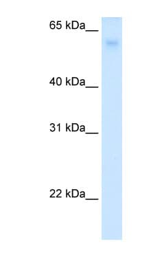 Polyclonal Rabbit anti-Human SLC2A2 / GLUT2 Antibody (N-Terminus, WB)