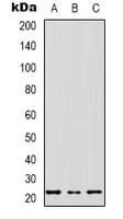 MRPS17 Antibody (N-Terminus)