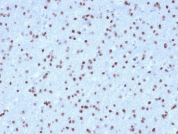 OLIG2 Antibody (clone OLIG2/2400)