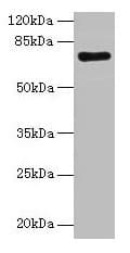 MYST2 / HBO1 Antibody