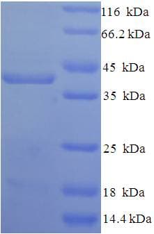 Human SDC1 / Syndecan 1 / CD138 Protein (Recombinant His-SUMO)
