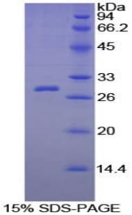 Guinea pig CRP / C-Reactive Protein (Recombinant His-S)