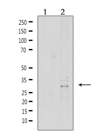 Polyclonal Rabbit anti-Human VTCN1 / B7-H4 Antibody (WB)