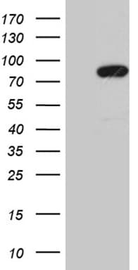 Monoclonal Mouse anti-Human MLH1 Antibody (clone OTI1B9, aa299-527, WB)