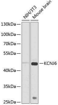 KCNJ6 / GIRK2 Antibody