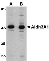 IHC-plus™ ALDH3A1 Antibody