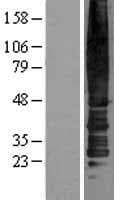 ACKR2 / CCR10 / D6 Protein (Over-Expression Lysate Myc-DDK (Flag))