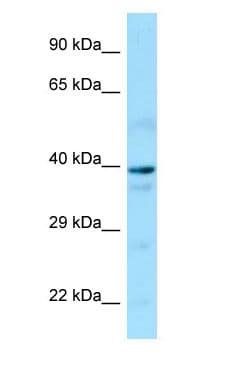 Polyclonal Rabbit anti-Human GNA14 Antibody (aa24-73, WB)