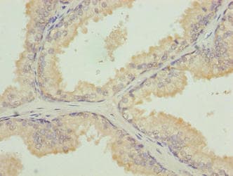 Polyclonal Rabbit anti-Human TUBB1 / Tubulin Beta 1 Antibody (IHC, WB)