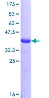 Human OSBP Protein (Recombinant GST, N-terminus)