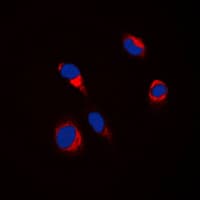 Tyrosinase Antibody (C-Terminus)