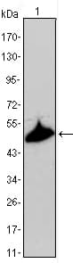 IHC-plus™ KRT15 / CK15 / Cytokeratin 15 Antibody (clone 6E7)