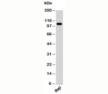 Polyclonal Rabbit anti-Human PACS1 Antibody (Internal, WB)