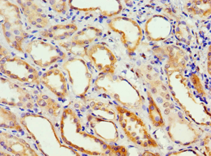 Polyclonal Rabbit anti-Human ADH4 Antibody (aa1-380, IHC)