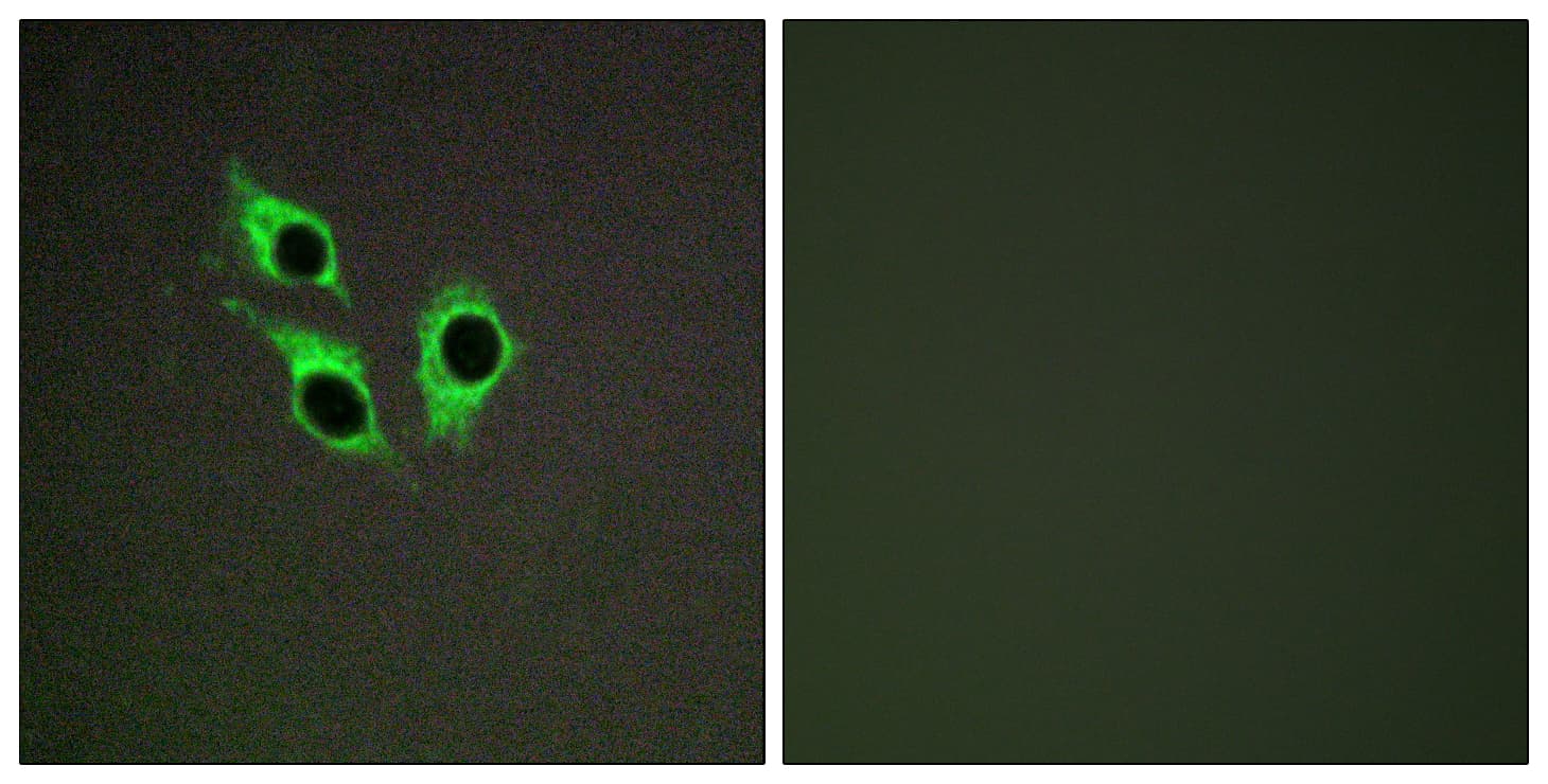 ANO9 / TMEM16J Antibody (aa481-530)