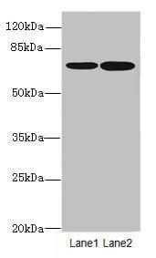 Polyclonal Rabbit anti-Human SLC23A2 / SVCT2 Antibody (IHC, WB)