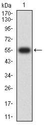 SETD7 / SET7 Antibody (clone 3D6G11)