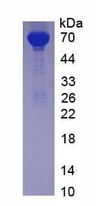 Rabbit ALB / Serum Albumin Protein (Native)