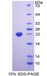 Human ANPEP / CD13 Protein (Recombinant His-T7)