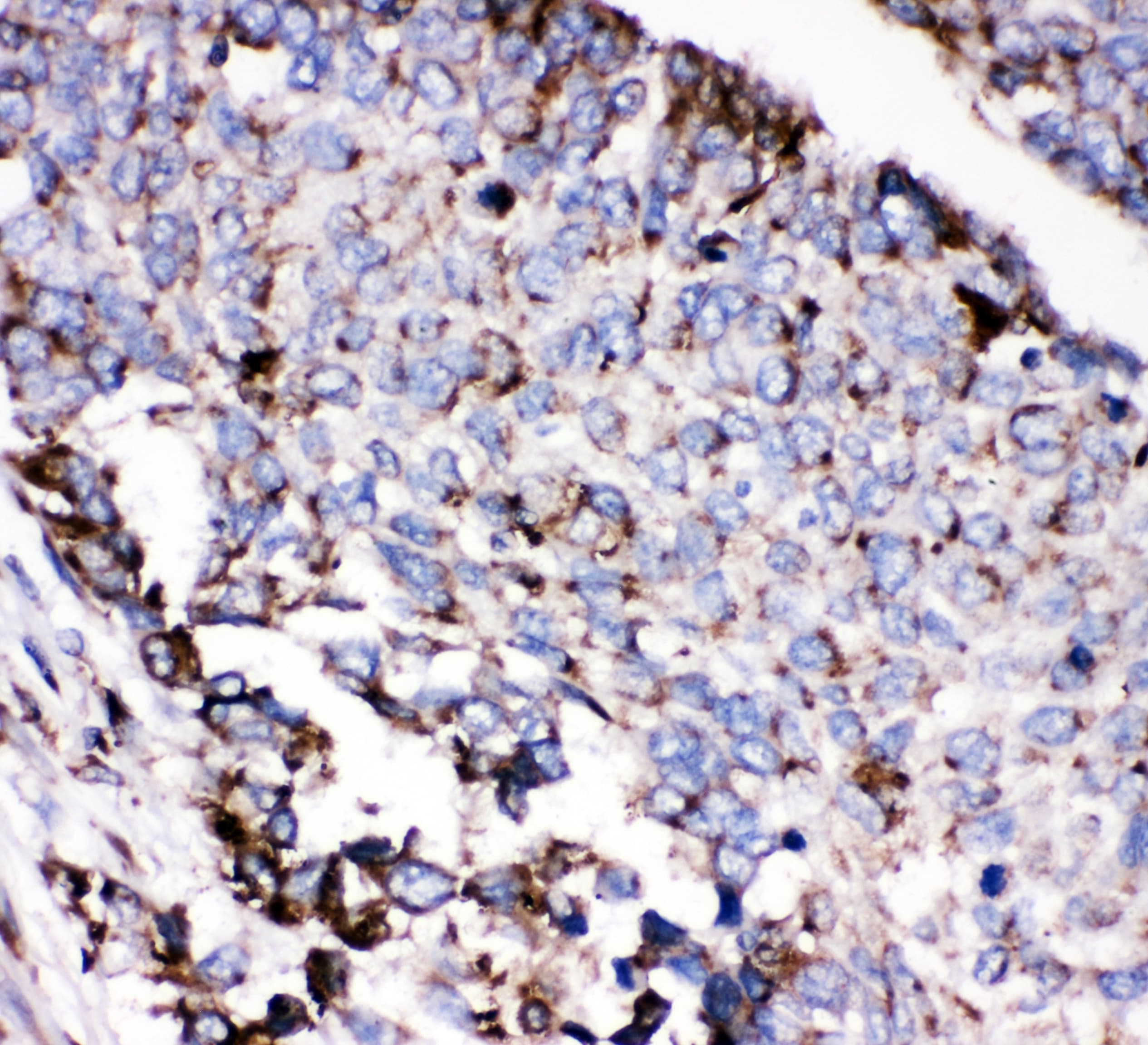 AEBP2 Antibody