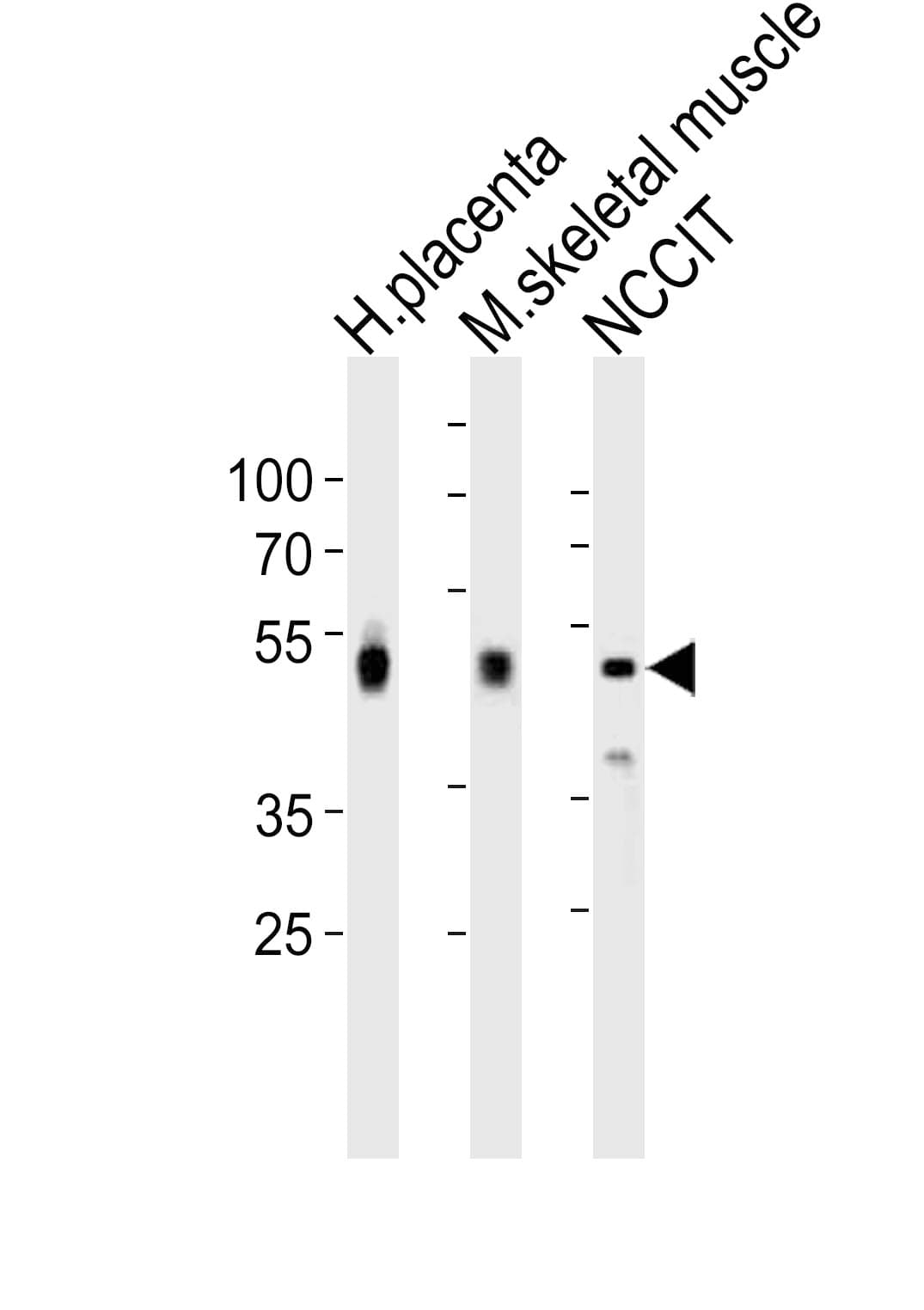 Polyclonal Rabbit anti-Human DLK1 / Pref-1 Antibody (aa368-402, WB)