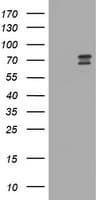 RIOK2 Antibody (aa277-552, clone OTI2F4)