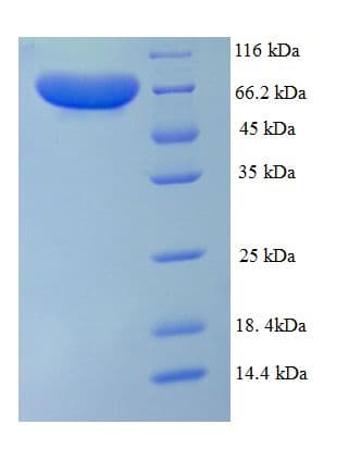 Human PADI1 Protein (Recombinant His)
