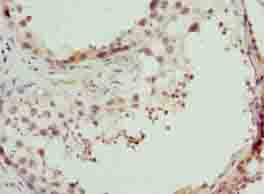 CPXCR1 / CT77 Antibody